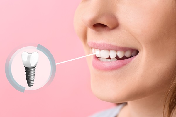 How Is A Dental Implant Placed?