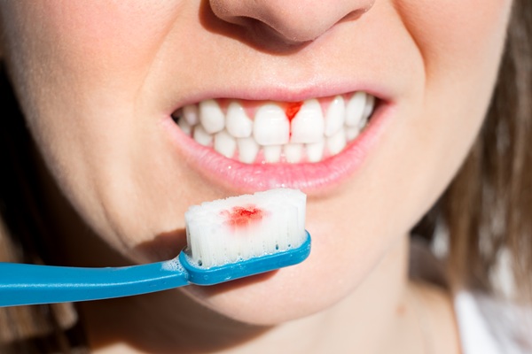 Can Gum Disease Be Treated At Home?